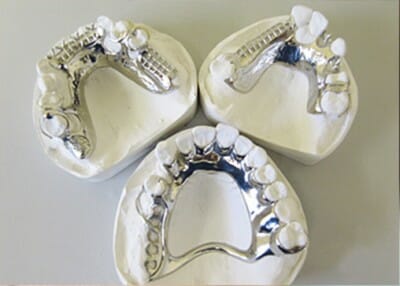 Chrome Dentures