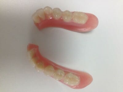 Fractured Denture Repair